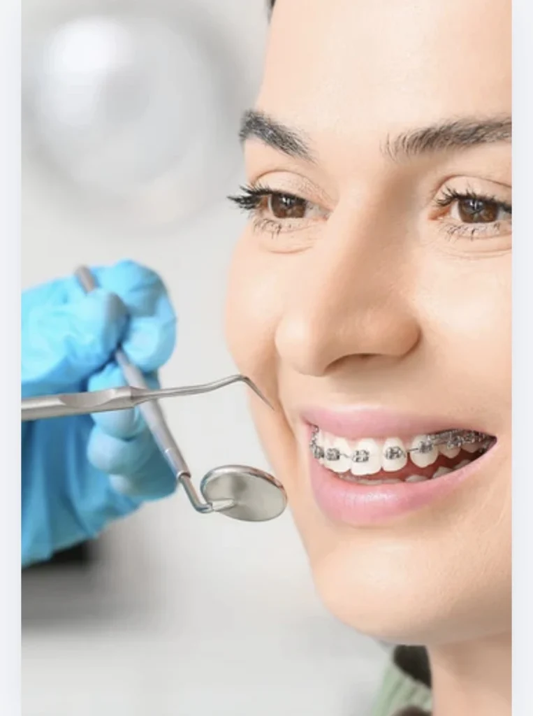 Braces Treatment