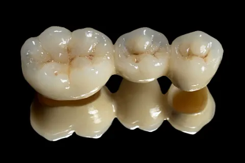 Dental Crowns