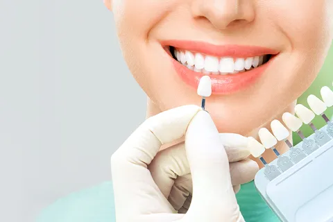 Smile Design