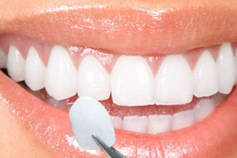 Cosmetic Dentistry Pune