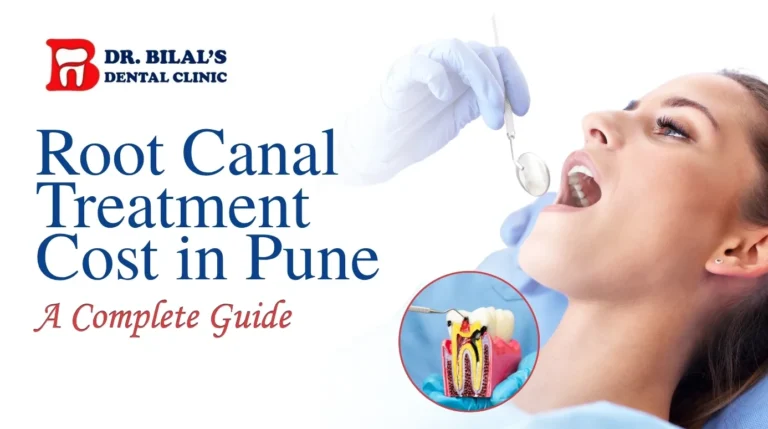 Root Canal Treatment Cost in Pune