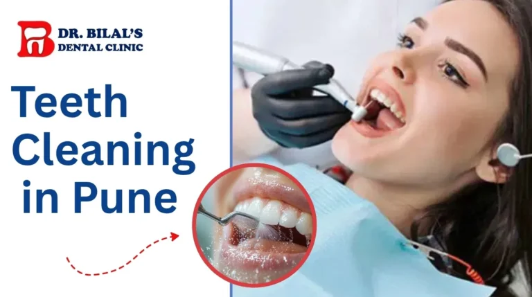 Teeth Cleaning in Pune