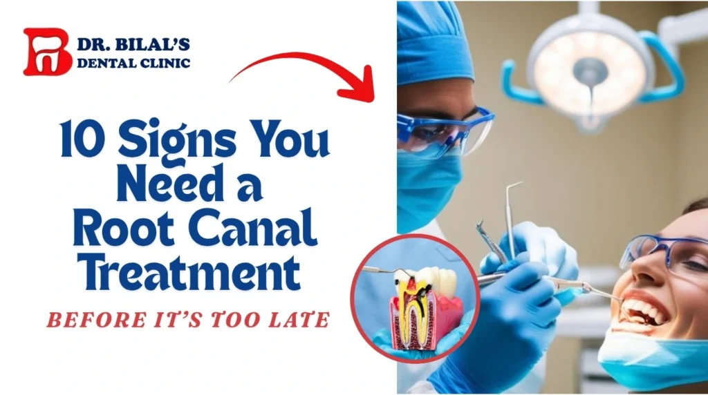 Root Canal Treatment