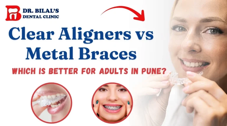 Clear Aligners vs Metal Braces