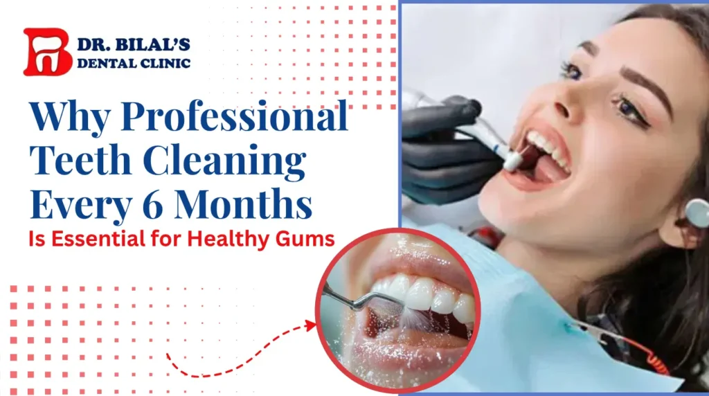 Teeth Cleaning in Pune