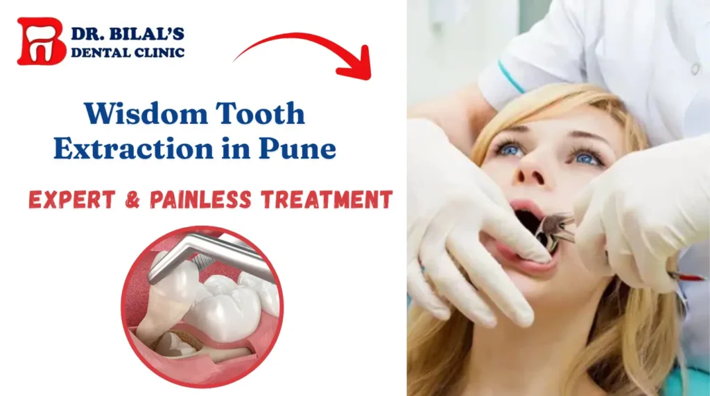 Wisdom Tooth Extraction in Pune