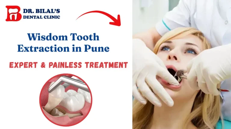 Wisdom Tooth Extraction in Pune